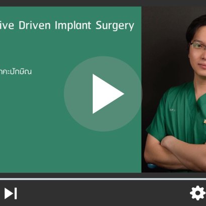 Restorative Driven Implant