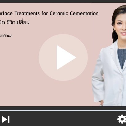 Surface Treatment for Ceramic