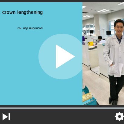 Esthetic Crown Lengthening