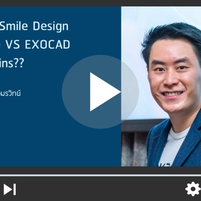 Digital Smile Design VS Exocad