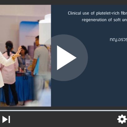 PRF Tissue Regeneration