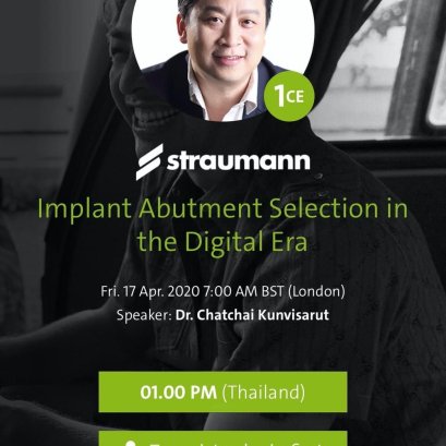 Abutment Selection