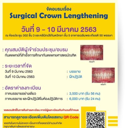 Surgical Crown Lengthening