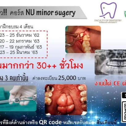 NU Minor Surgery