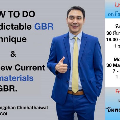 How to GBR