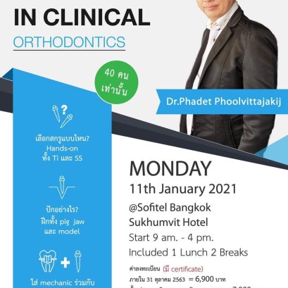 Miniscrews in Clinical Orthodontics