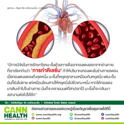 การทำคีเลชั่นช่วยเรื่องโรคมะเร็ง