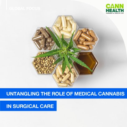 Untangling the role of medical cannabis in surgical care