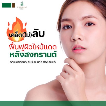 เคล็ดไม่ลับ ฟื้นฟูผิวไหม้แดด หลังสงกรานต์ ถ้าไม่อยากผิวเสียระยะยาว ต้องรีบแก้