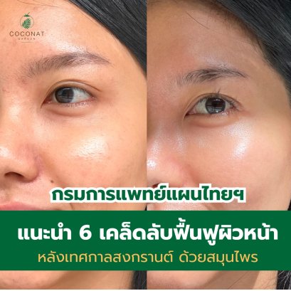 6 เคล็ดลับ ฟื้นฟูผิวหน้า ผิวพรรณ หลังเทศกาลสงกรานต์ ด้วยสมุนไพร ช่วยให้ผิวหน้า ผิวพรรณ กลับมาเนียนใส 