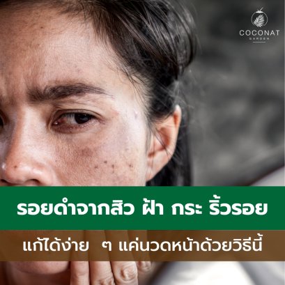 แก้ปัญหารอยดำจากสิว ฝ้า กระ และริ้วรอยได้เป็นอย่างดี แค่นวดหน้าด้วยน้ำมันมะพร้าวสกัดเย็น