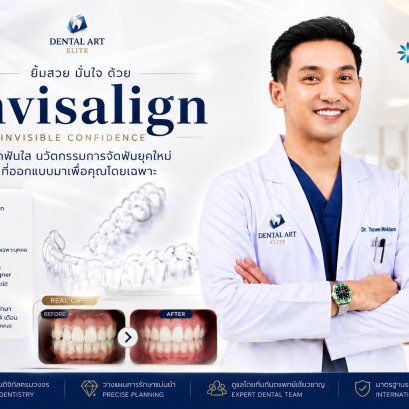 เคสจัดฟันใส Invisalign ก่อนและหลัง | Dental Art Elite