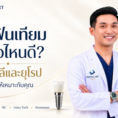 Which Dental Implant Brand Is Best? Compare Brands, Prices and How to Choose | Dental Art Elite