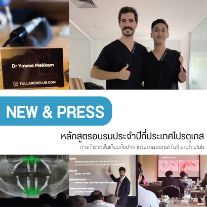 อ.ทพ.ยาวี รากฟันเทียมทั้งปาก l international full arch club 
