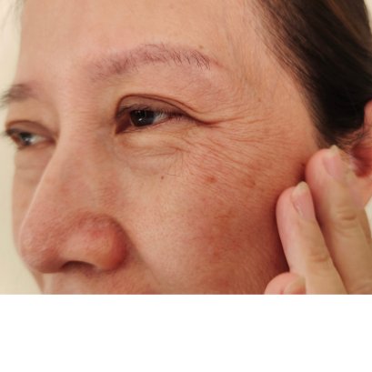 Ep.9 ผลิตภัณฑ์ลดเลือนริ้วรอย