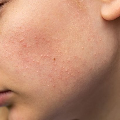 รู้ก่อนจ้างโรงงานรับผลิตเครื่องสำอาง