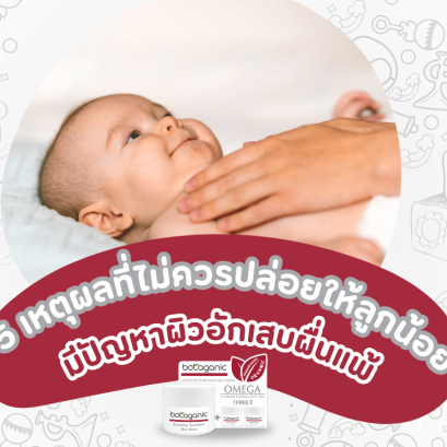 โบทาแกนิค บาล์ม บาล์ทาผิวเด็ก บาล์มแก้ผดผื่น บาล์มแก้คัน ผื่นแพ้ แมลงกัดต่อย ออร์แกนิก โอเมก้าบาล์ม บาล์แก้แพ้ ผิวบอบบาง ผิวทารก ผู้ป่วยติดเตียง ผื่นแดงคัน โบทาแกนิก โอเมก้าบาล์ม โอเมก้า 3 6 9