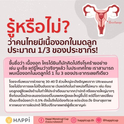 เนื้องอกมดลูก