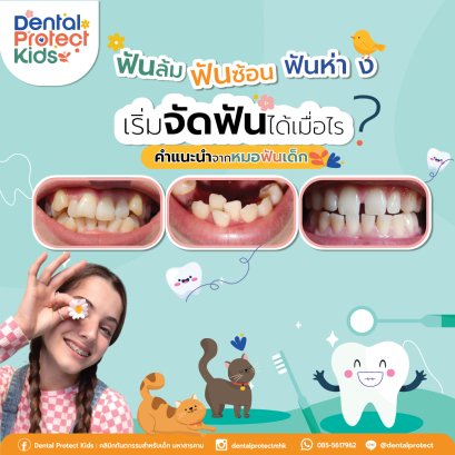 ฟันล้ม ฟันซ้อน ฟันห่าง เริ่มจัดฟันได้เมื่อไร? คำแนะนำจากหมอฟันเด็ก