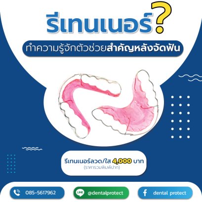 รีเทนเนอร์คืออะไร? ทำความรู้จักตัวช่วยสำคัญหลังจัดฟัน