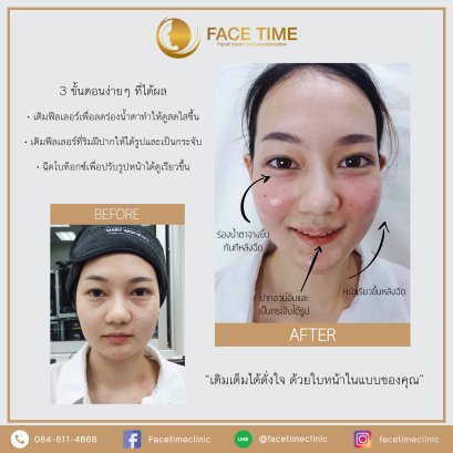 รีวิวลูกค้า FaceTime Clinic เชียงใหม่