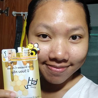 ใครที่กำลังจะไปทำเมโสหรือโบท๊อกซ์.. ใจเย็นๆ ลองนี่ก่อน Fuji Bee venom Cream