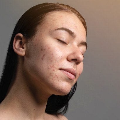 หมดปัญหาผิวหน้าหมองคล้ำ ด้วยการเลือกใช้ Skincare ให้เหมาะกับปัญหา