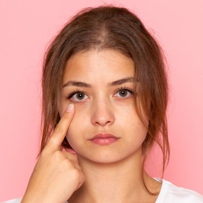 อะไรช่วยลดรอยคล้ำใต้ตา ได้บ้าง ?