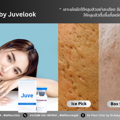 JuveLook ไหมน้ำตัวใหม่ ไฮบริท Biostimulator ที่มาแรงที่สุดในตอนนี้
