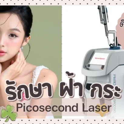 รักษาฝ้า กระ