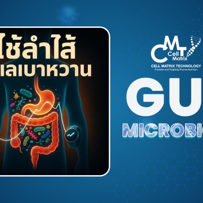 AI + จุลินทรีย์ลำไส้ ปฏิวัติการดูแลเบาหวาน