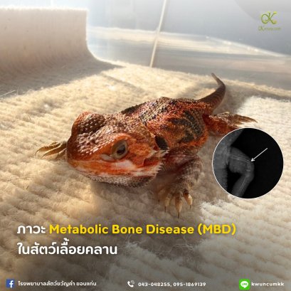 Metabolic Bone Disease (MBD)