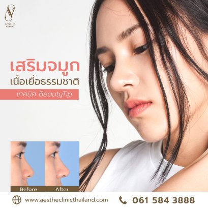 เสริมจมูก สันสโลป ปลายเชิด เพิ่มมิติใบหน้า - Aesthe Clinic