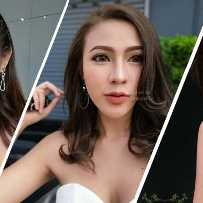 ปากกระจับ เพิ่มมิติ ยกยิ้ม อย่างเป็นธรรมชาติ - Aesthe Clinic