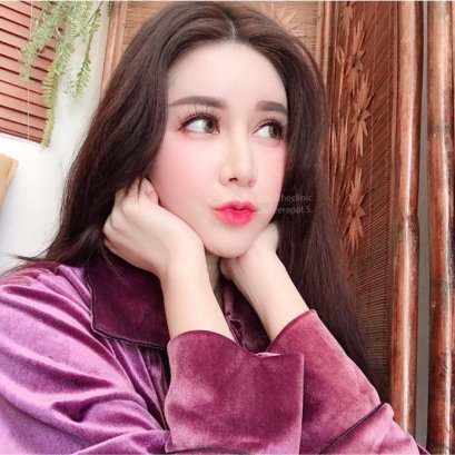 ปากกระจับ เพิ่มเสน่ห์ ยกยิ้ม อย่างเป็นธรรมชาติ - Aesthe Clinic