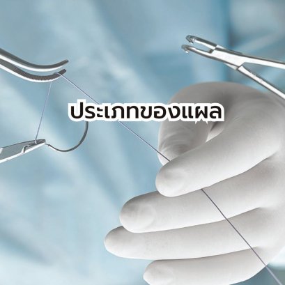 ประเภทของแผล