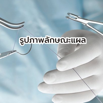 รูปภาพลักษณะแผล