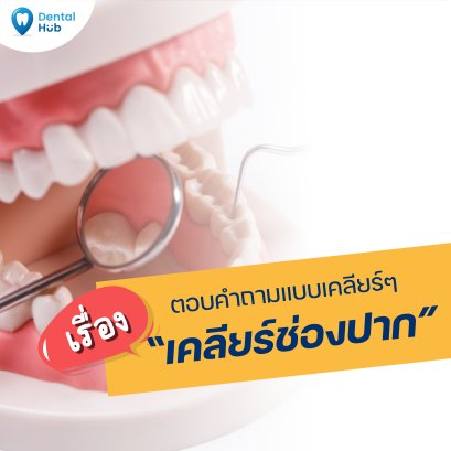 ตอบคำถามแบบเคลียร์ๆ เรื่องเคลียร์ช่องปาก