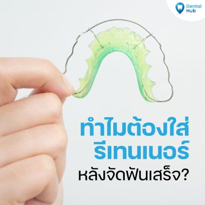 ทำไมต้องใส่รีเทนเนอร์หลังจัดฟันเสร็จ?