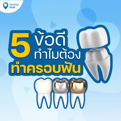 5ข้อดีทำไมต้องทำครอบฟัน