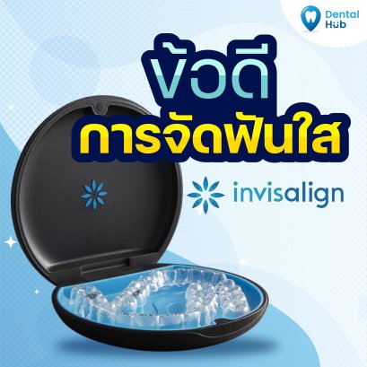 ข้อดีการจัดฟันใส