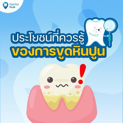 ประโยชน์ที่ควรรู้ของการขูดหินปูน