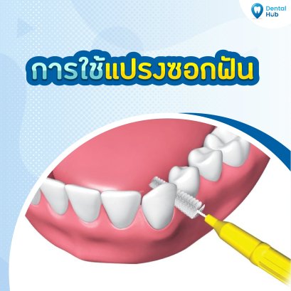 วิธีใช้แปรงซอกฟัน