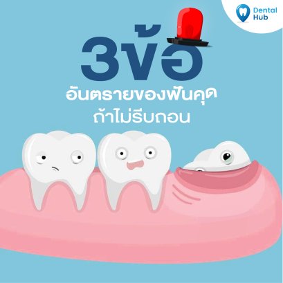 3ข้อ อันตรายของฟันคุด ถ้าไม่รีบถอน!