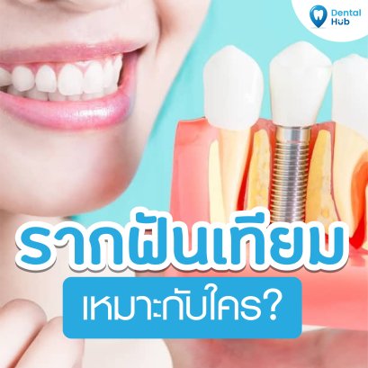 รากฟันเทียมเหมาะกับใคร