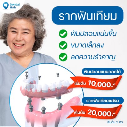 ฟันปลอมแบบใช้รากฟันเทียมเสริม