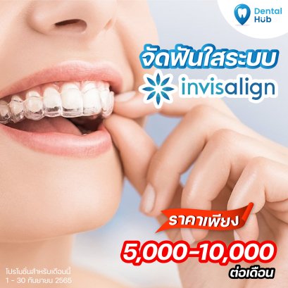 จัดฟันแบบใส 
