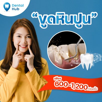 ขูดหินปูน