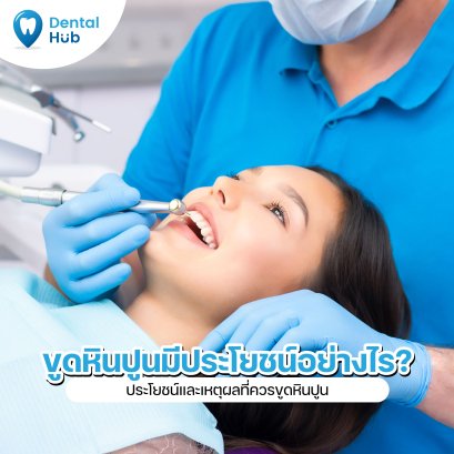 ขูดหินปูน มีประโยชน์อย่างไร