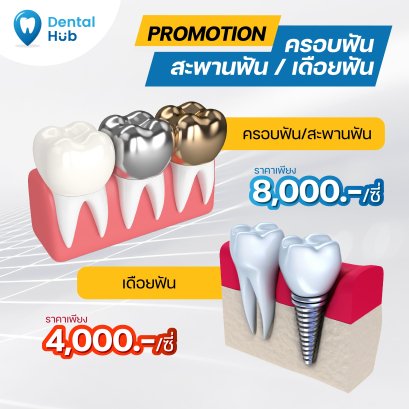 ครอบฟัน/สะพานฟัน/เดือยฟัน  